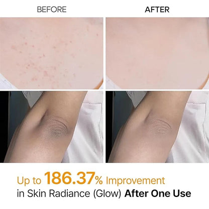 Dr.Melaxin - Peel Shot Kojic Ac