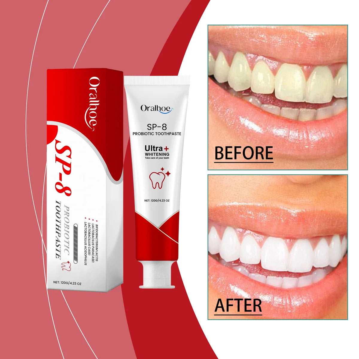 SP-8 Probiotic Dental Care Toothp