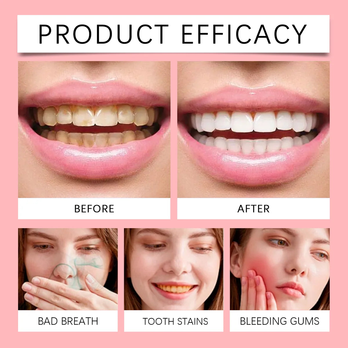 SP-8 Probiotic Dental Care Toothp